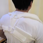 鎖骨骨折　保存療法　国分寺こみね鍼灸整骨院