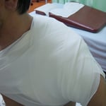 左鎖骨骨折　保存療法　包帯固定　国分寺こみね鍼灸整骨院