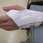 自分で取り外しのできるギプス　保存療法　国分寺こみね鍼灸整骨院