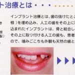 STEP5 機能回復治療