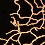 Seepferdchen Denisi, sogar ein schwangerer Herr, die Dame kehrt den Tücken