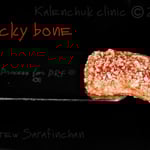 Приготування липкого кістково-замінного матеріалу