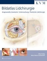Fratila: Bildatlas Lidchirurgie Anatomie | Untersuchung | Schnitttechniken