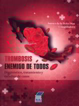 Trombosis - Enemigo de todos. Diagnóstico, tratamiento y estudios de casos