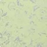 Fommy GLITTER ARABESQUE ggfarsg