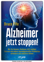 Alzheimer jetzt stoppen!