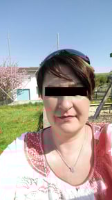 klientin, abnehmen, virtuelles magenband, vorher