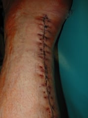 Dienstag 07.06.2005 bevor die letzten Fäden gezogen werden