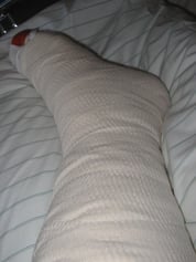 Mittwoch 25.05.2005 Gipstag im Krankenhaus