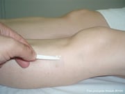 Acupuntura Biomagnetismo