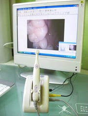 口腔内カメラ