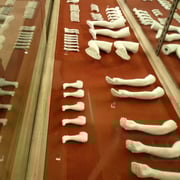 Les "abatis". depuis que Rodin connaît le succès, il a monté un atelier où des petites mains travaillent pour lui. A Meudon, on lui prépare ces moulages de parties de corps (les abatis) que le maître pourra assembler à sa guise.