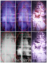 10 - collage anomalia e dettaglio