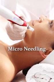 MicroNeedling Zürich