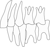 下顎が後退し深い前歯の噛み合わせ