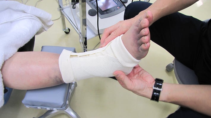 右腓骨骨折　保存療法　国分寺　こみね鍼灸整骨院