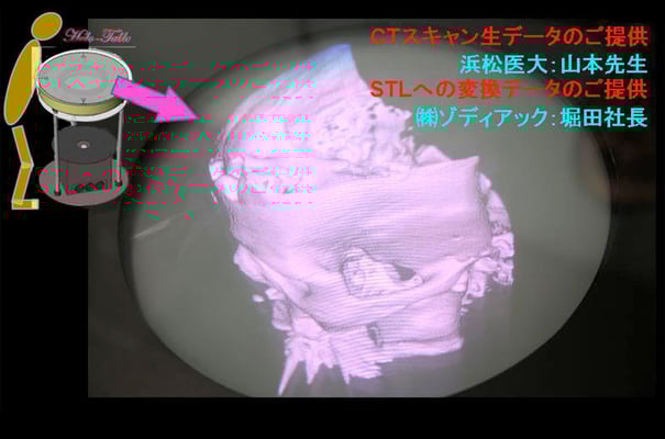 10_360degMedical 3D image表示に成功！