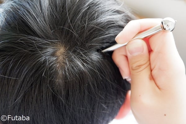 how-to-use-enrishin-acupuncture