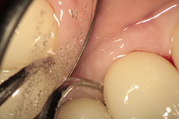 IMG_2017_03_17_9_141