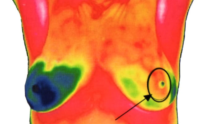 verdächtiger Befund links