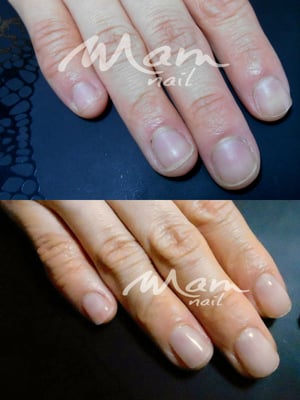 富士市ネイルサロン,深爪矯正専門,MamNail,富士市深爪,深爪静岡,深爪治したい