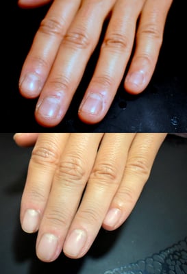 富士市ネイルサロン深爪矯正専門MamNail