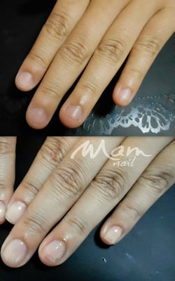 富士市ネイルサロン深爪矯正専門MamNail,深爪富士市,深爪矯正,