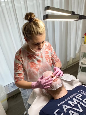 Microneedling, Behandlung