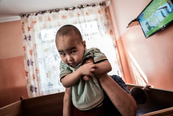 Akhmetov Emirzhan 2 years old, cerebral palsy, tetraparesis, atrophy of the optic nerve. Orphanage for handicapped children, Semey, Kazakhstan