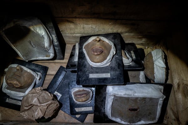 Models showing the possible effects of radiation on skin and mucous membranes