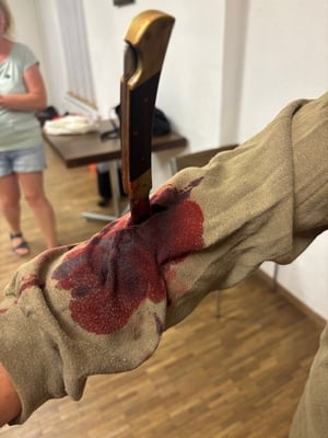 Stichverletzung am Unteram