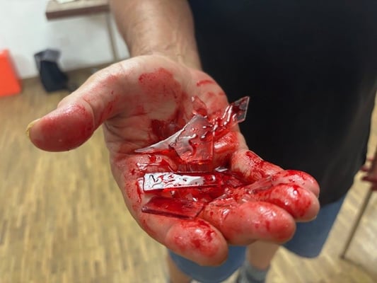 Schnittwunde in Handinnenfläche