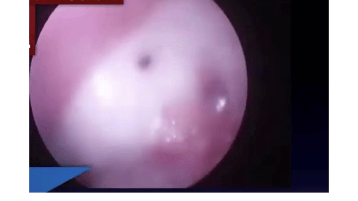 肺の入口を覆っている