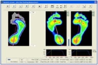 Estudio y análisis de la pisada en Murcia