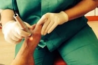 Tratamiento con láser para hongos en uñas en Murcia