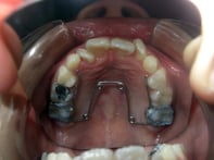 リンガルアーチ