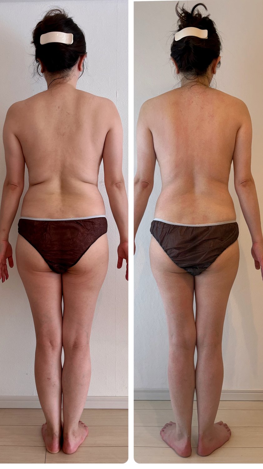 【お客様の変化】3ヶ月で−4.7kg！同期会までに痩せられた！