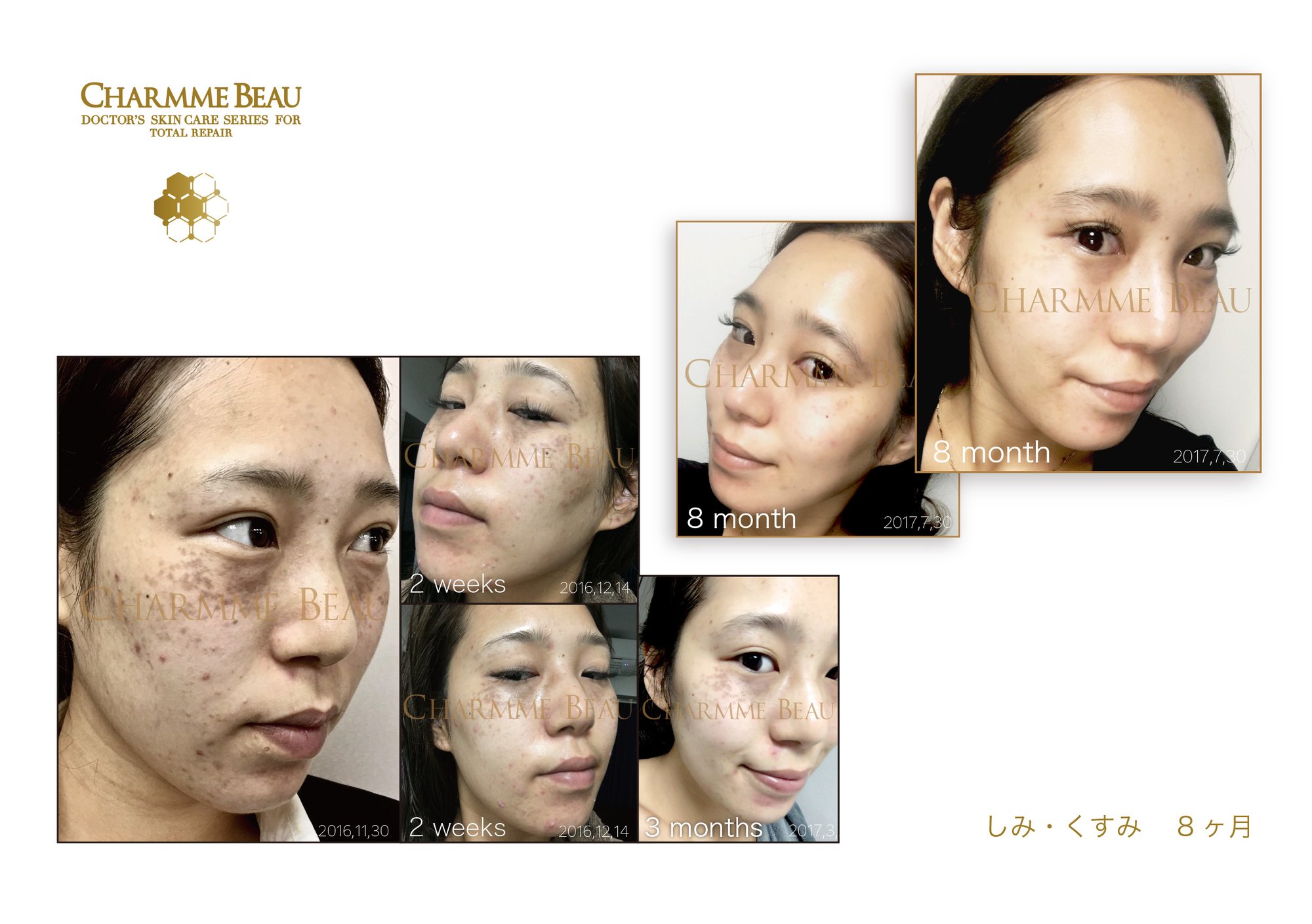 シャルム・ボー化粧品取り扱い始めました。