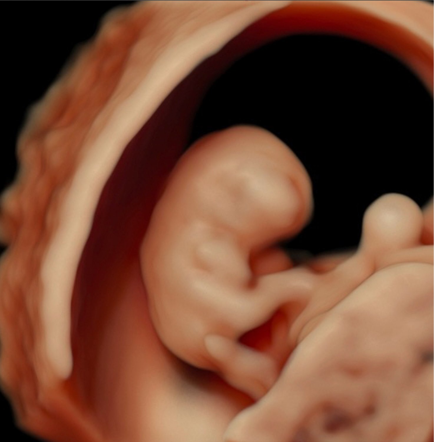 Fortbildung am 24. 04. 2025: Lippen-Kiefer-Gaumenspalte – von der Diagnose zur Therapie