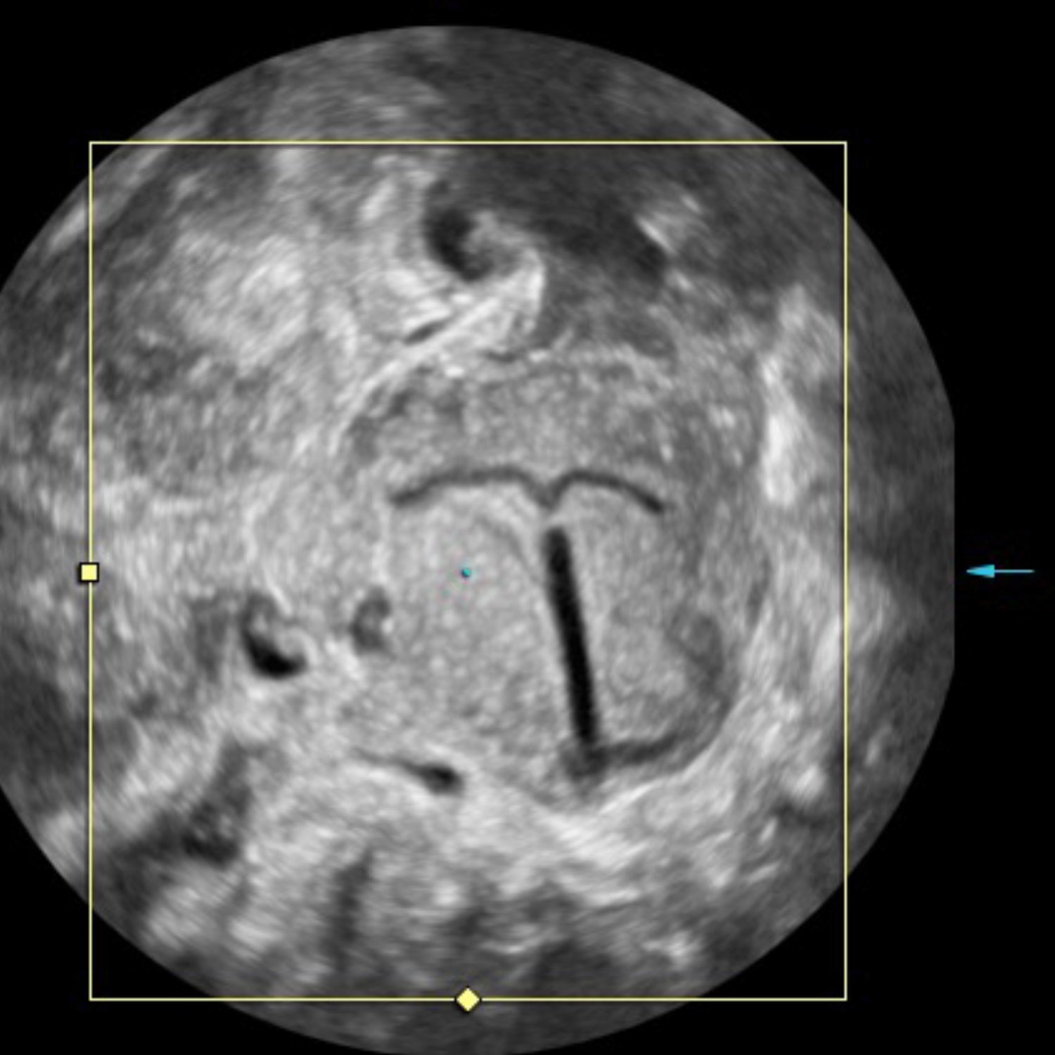 Fortbildung: »AI in der Ultraschalldiagnostik« und »3D-Ultraschall in der Gynäkologie«