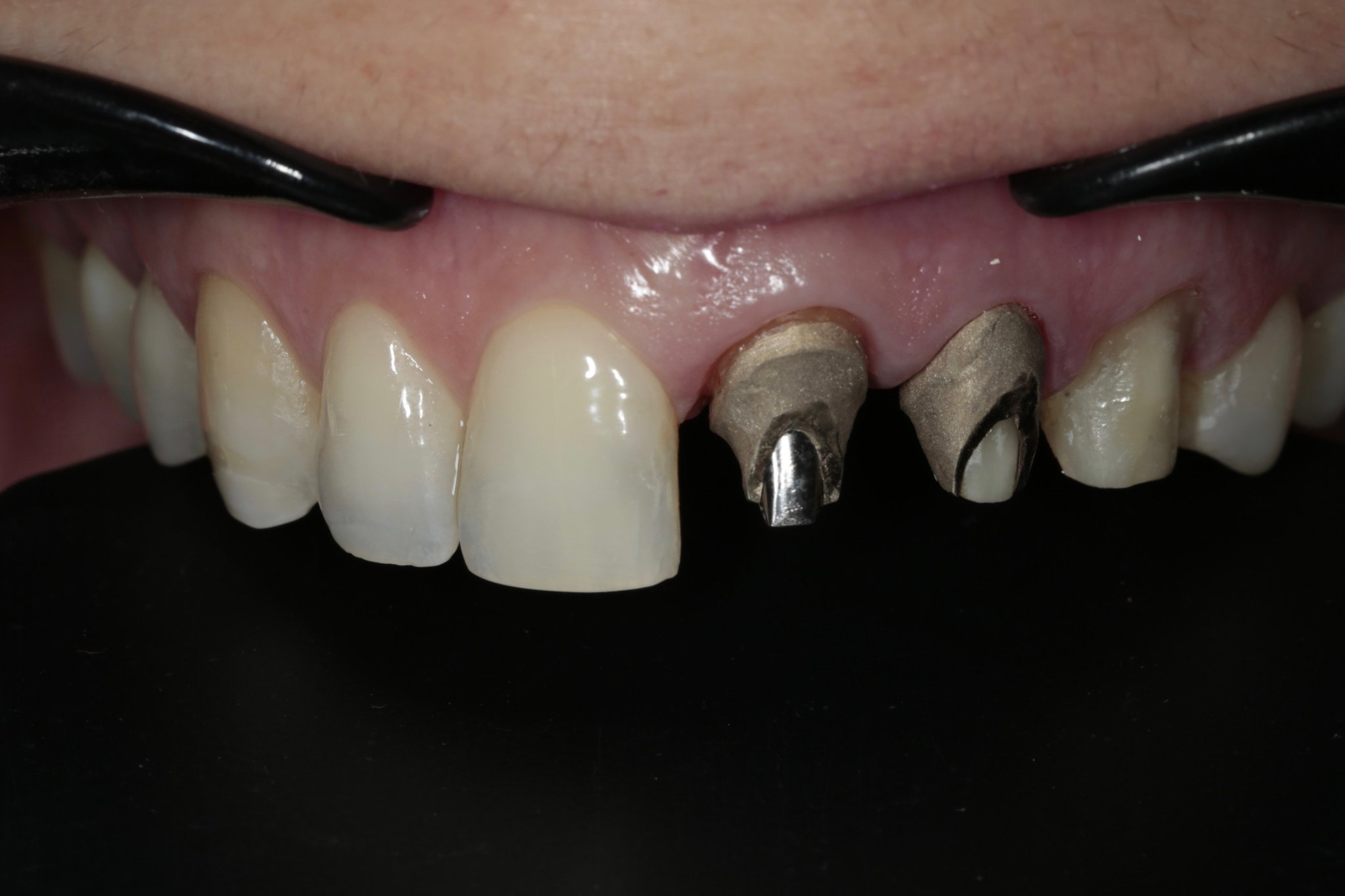 Case-1. Copy in MO.O creation LS