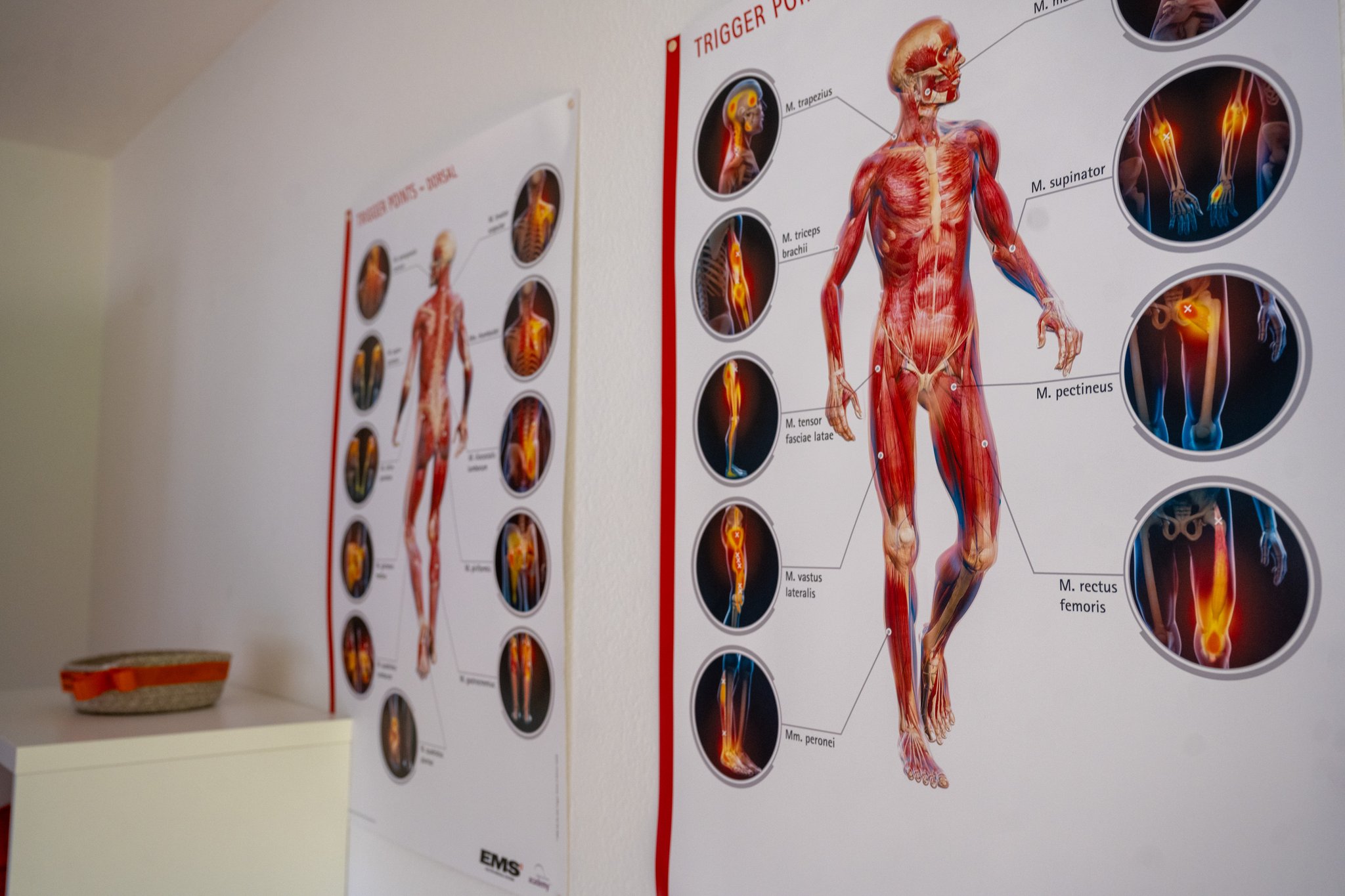 Poster mit Triggerpunkten