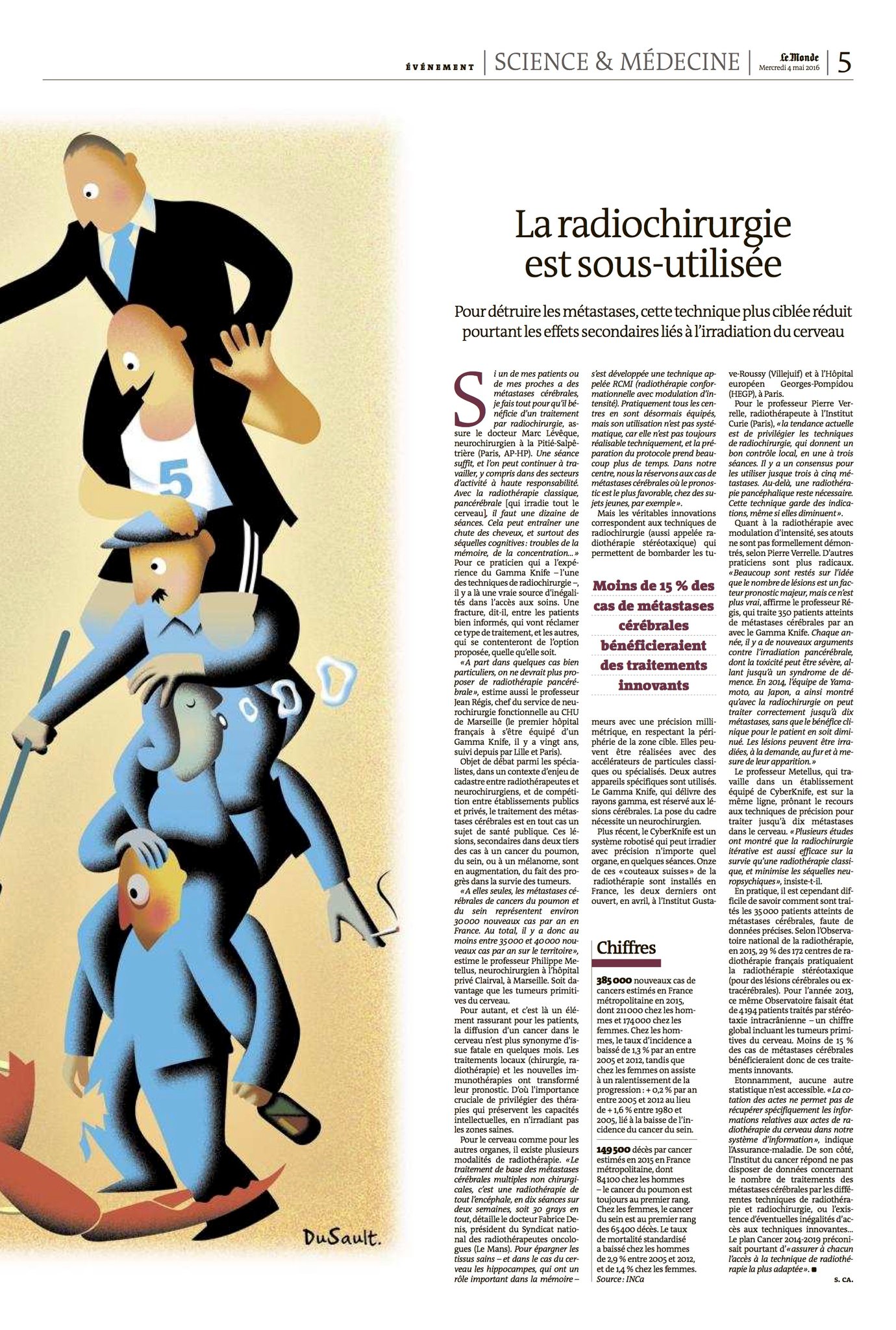 Le Monde - La radiochirurgie est sous-utilisée - 02/05/16  