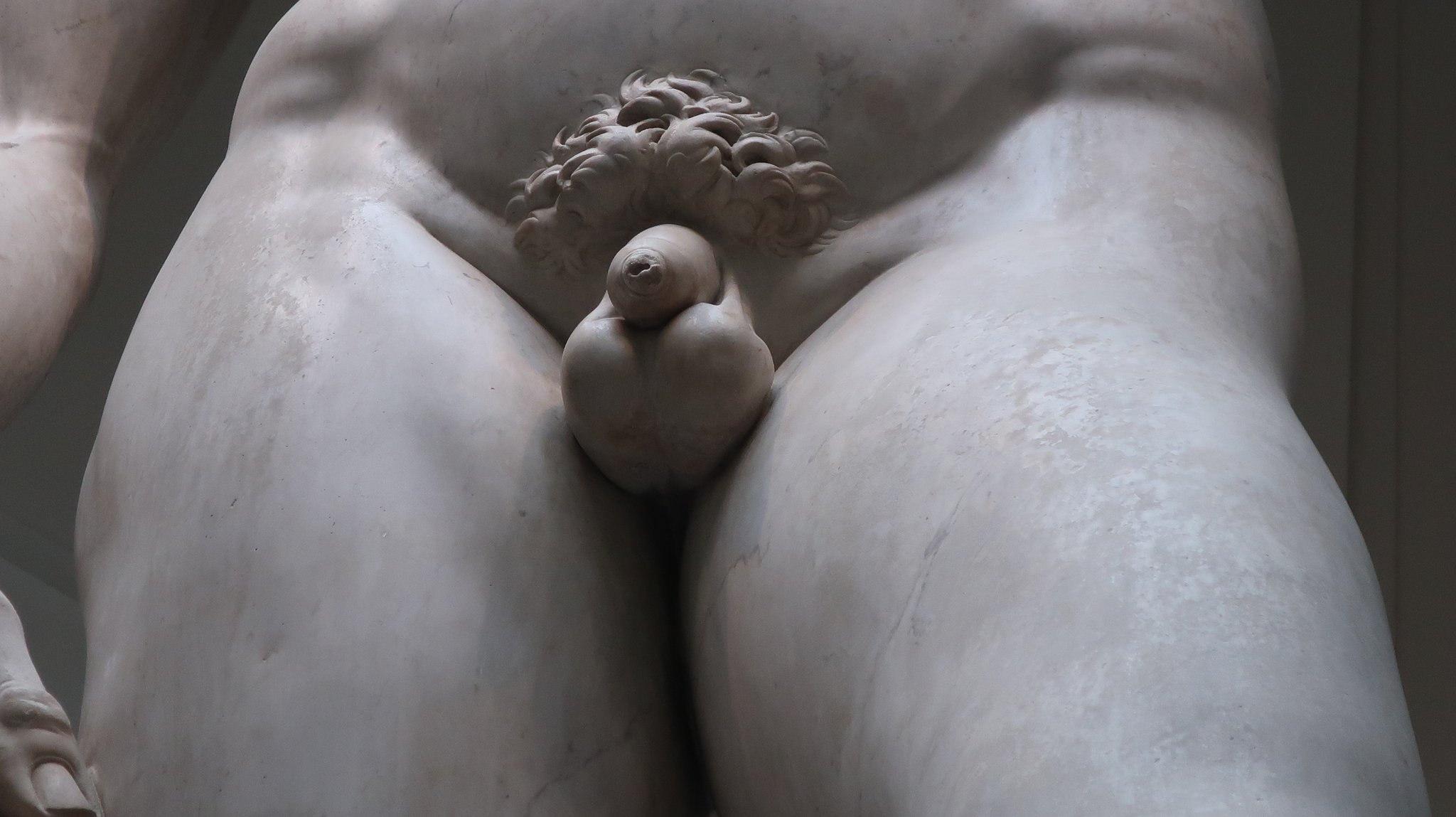 左の睾丸が下垂、ユダヤ人なのに包茎