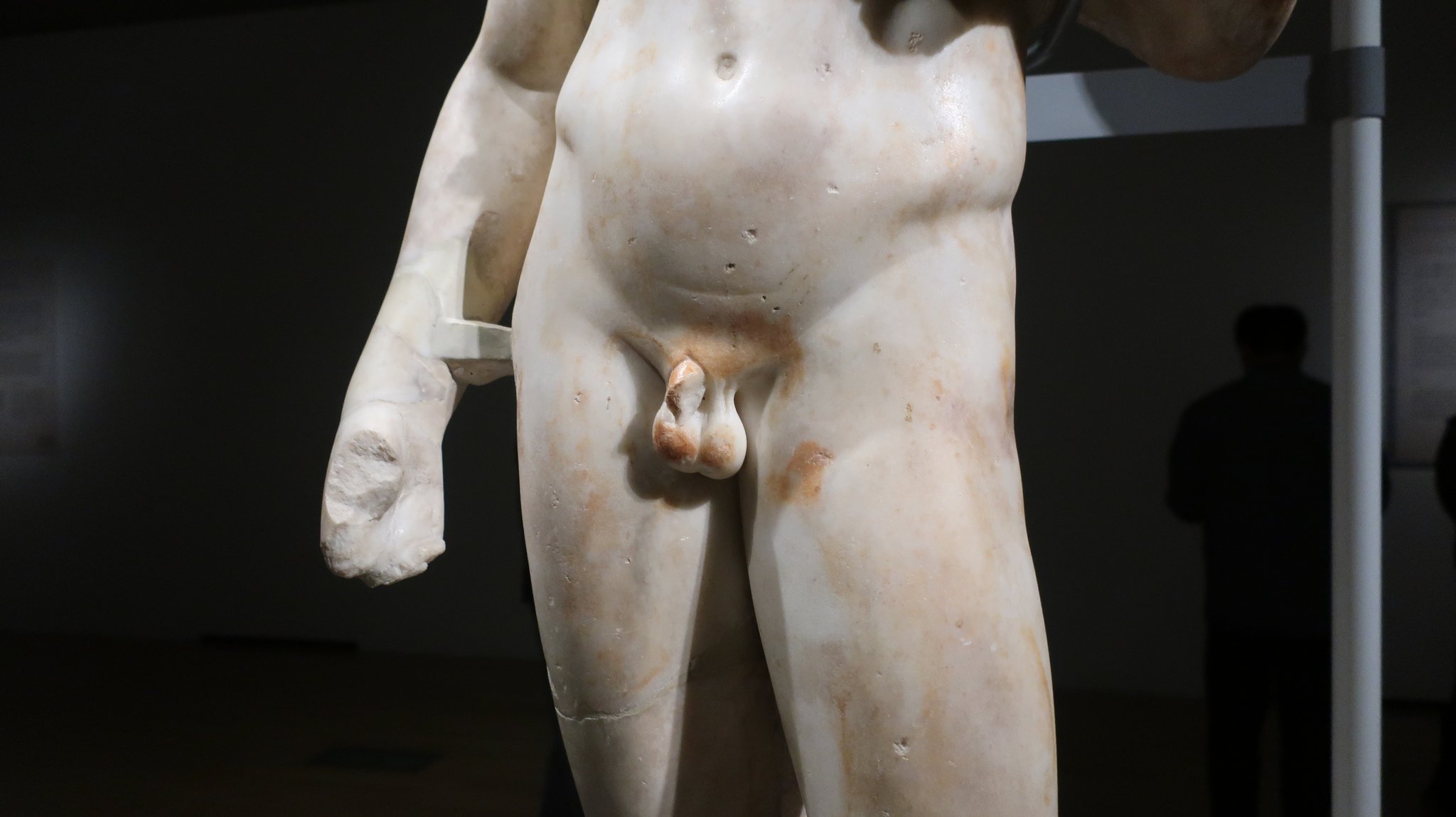 やはり左睾丸が右より下垂しています。