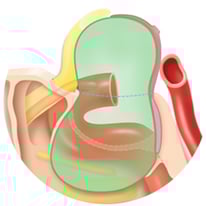 Schaubild Hypophysenadenom