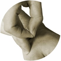 Akupunktur Behandlung