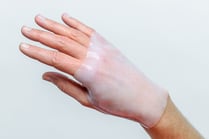 PPM Fisteladapter Produktfoto