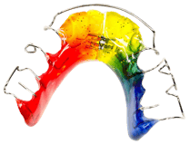 Braucht mein Kind eine Zahnspange? Wir beraten Sie! (© Michael Tieck - Fotolia.com)