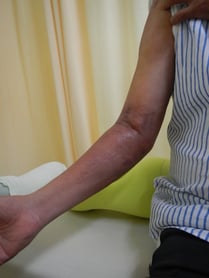 国分寺こみね鍼灸整骨院　リハビリマッサージ